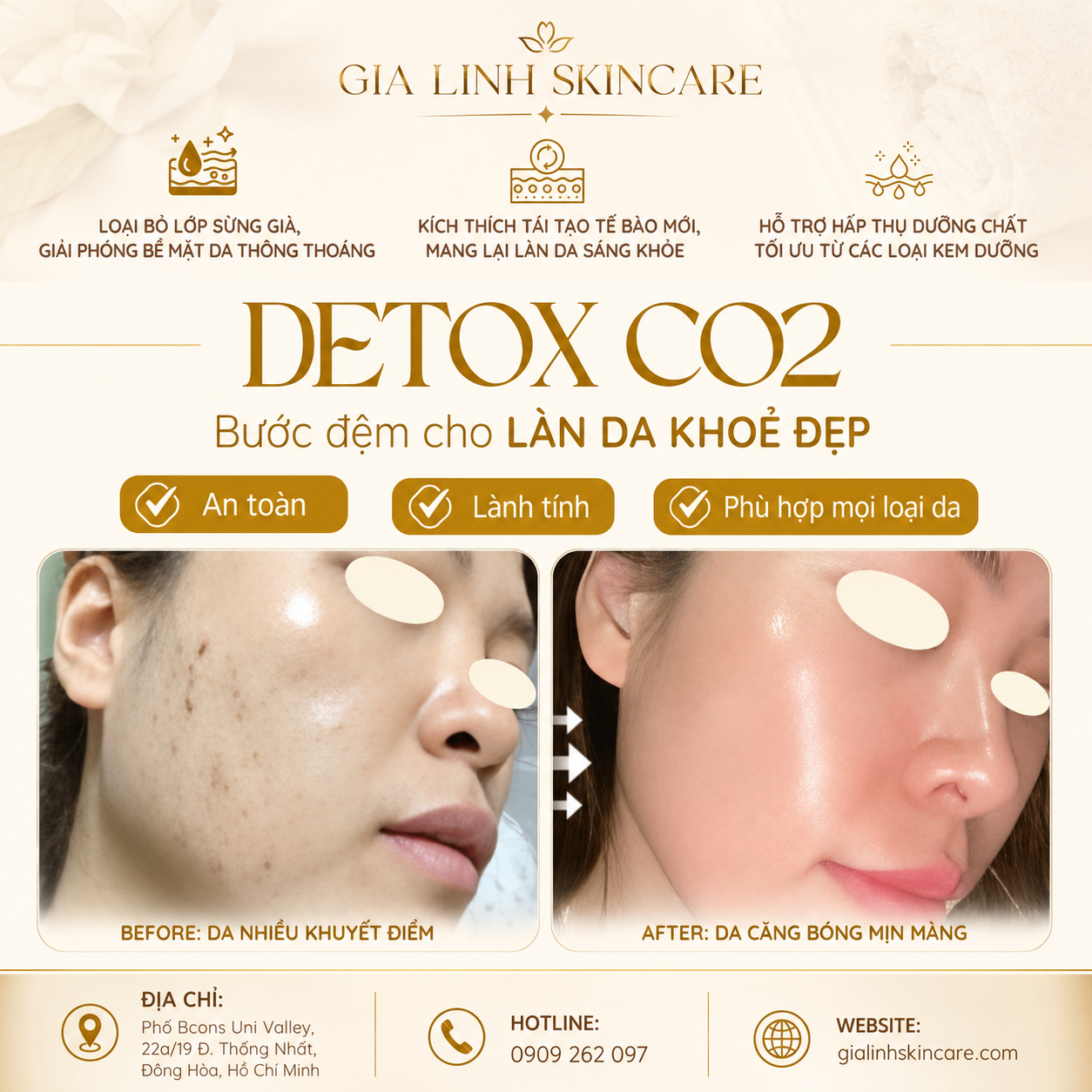 Detox Mụn CO2 Tại Gia Linh Skincare – Xu Hướng Chăm Sóc Da Hiện Đại Được Nhiều Khách Hàng Lựa Chọn